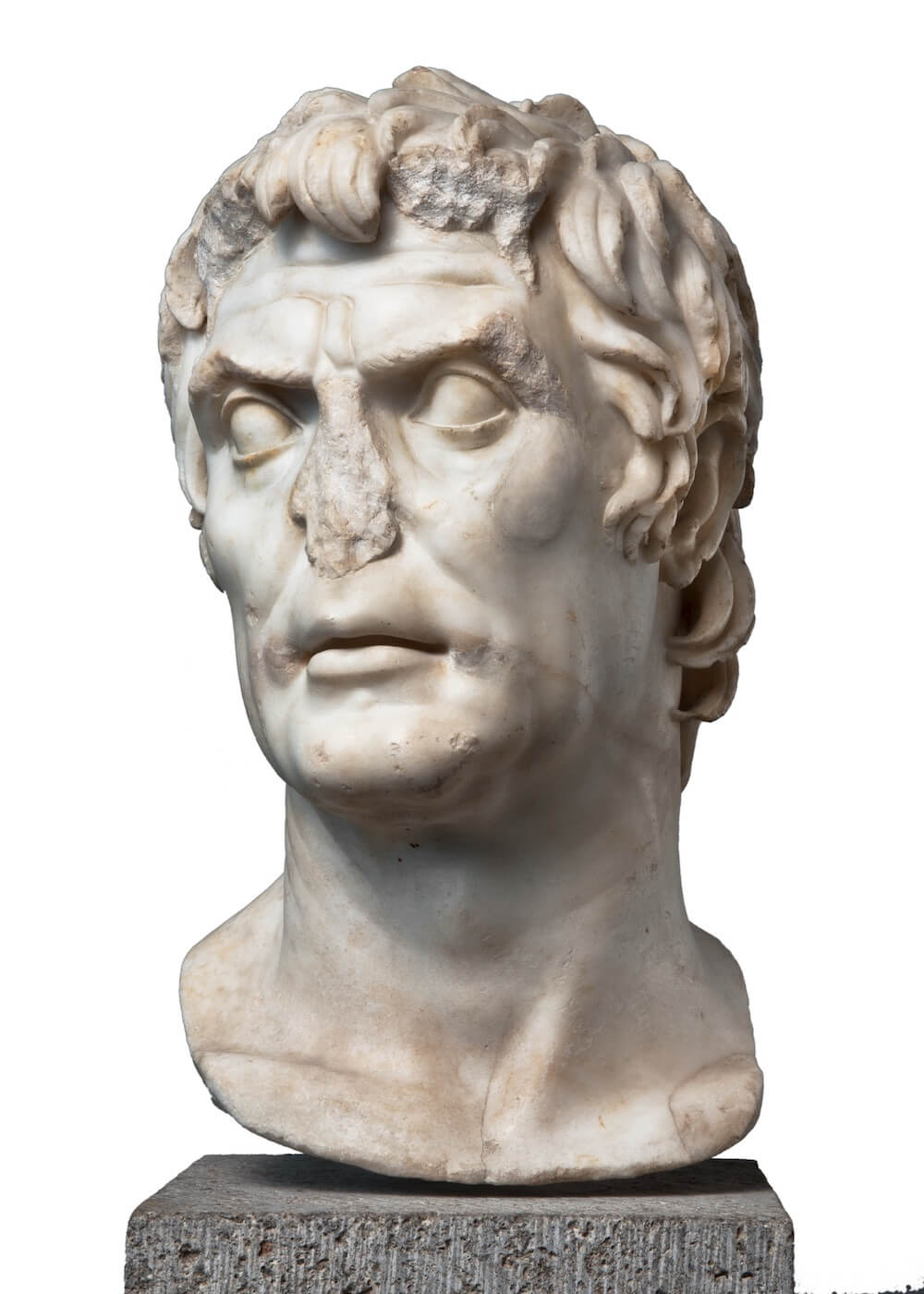 A marble head of a man. He has thick locks of hair and lines on his forehead. His nose has been broken off entirely.